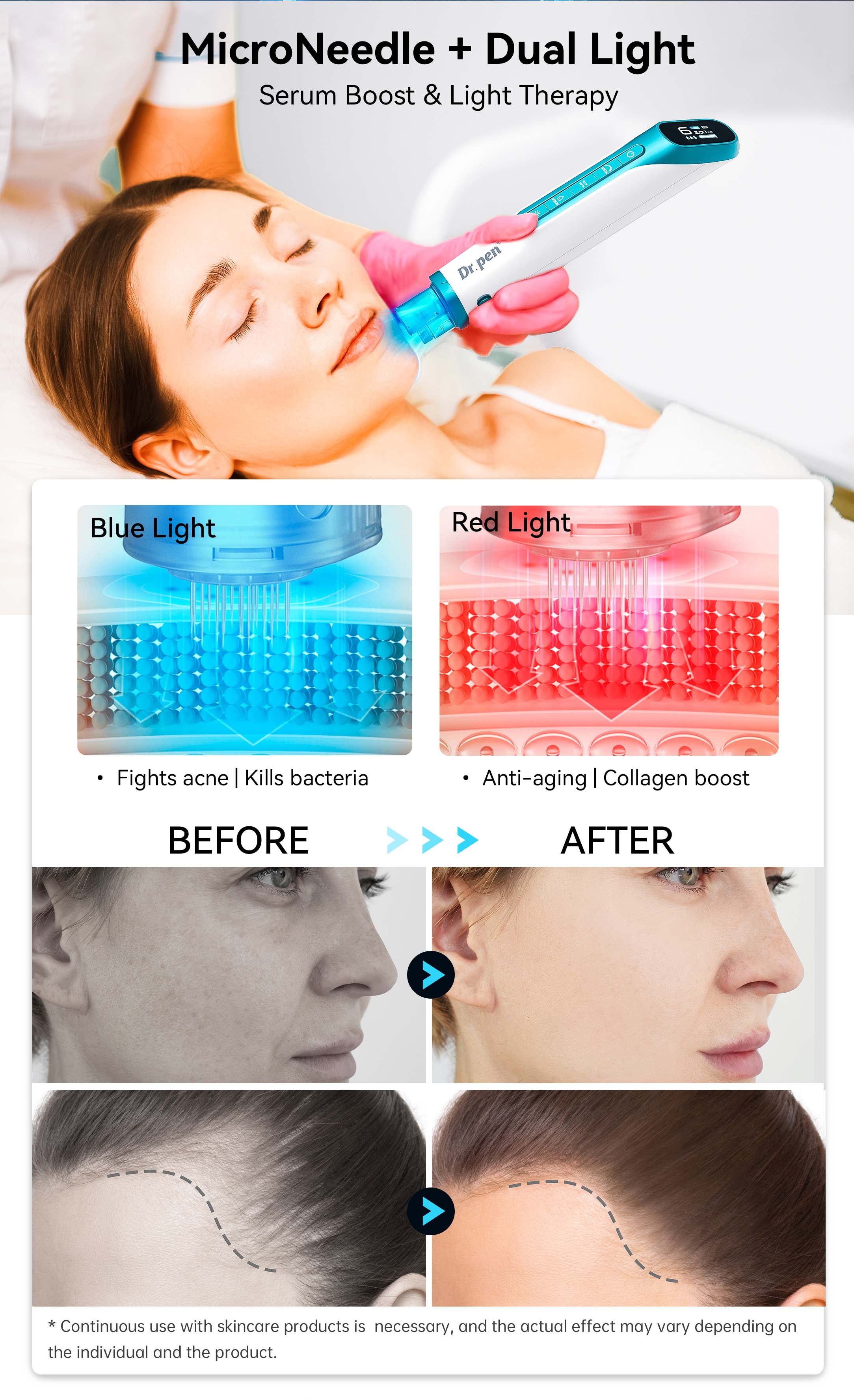 Dr. Pen application