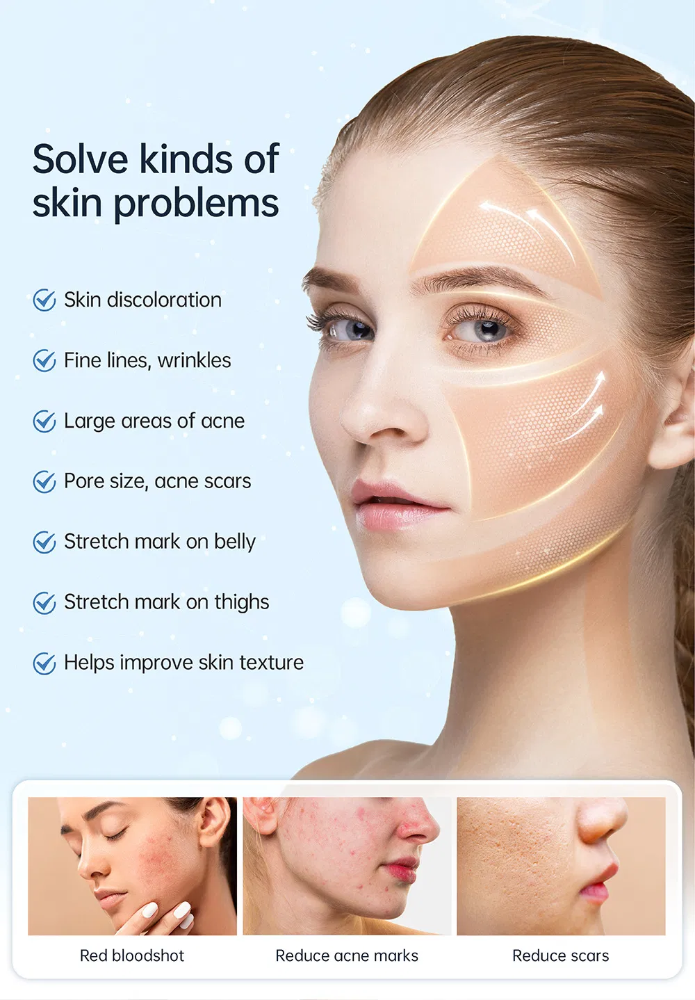 Advanced EMS Microneedle Beauty Device for Home Use