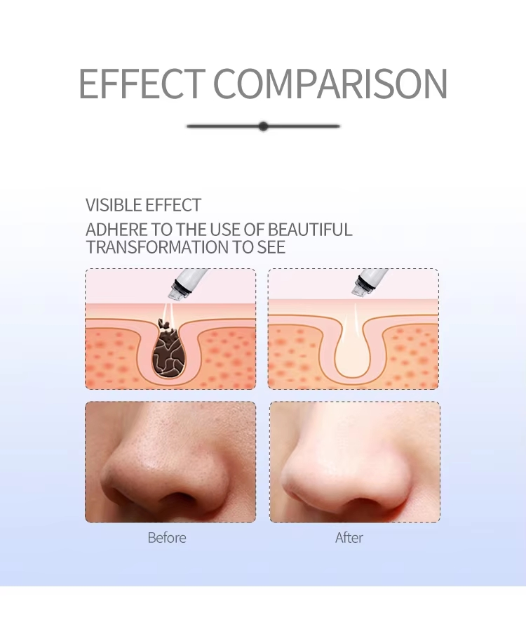 Home Use Beauty Rechargeable Vacuum Blackhead Remover Cleaning Device
