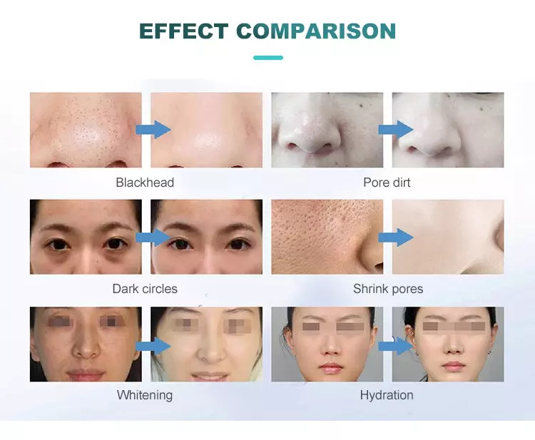 9 in 1 Facial Cleaning Machine Detail