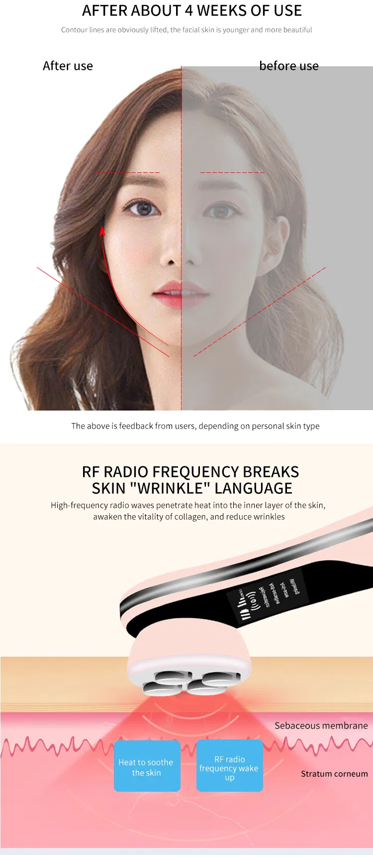 RF Frequency LED Facial Lifting Skin Tightening Blackhead Pore Cleaner Wrinkle Remover Beauty Massager