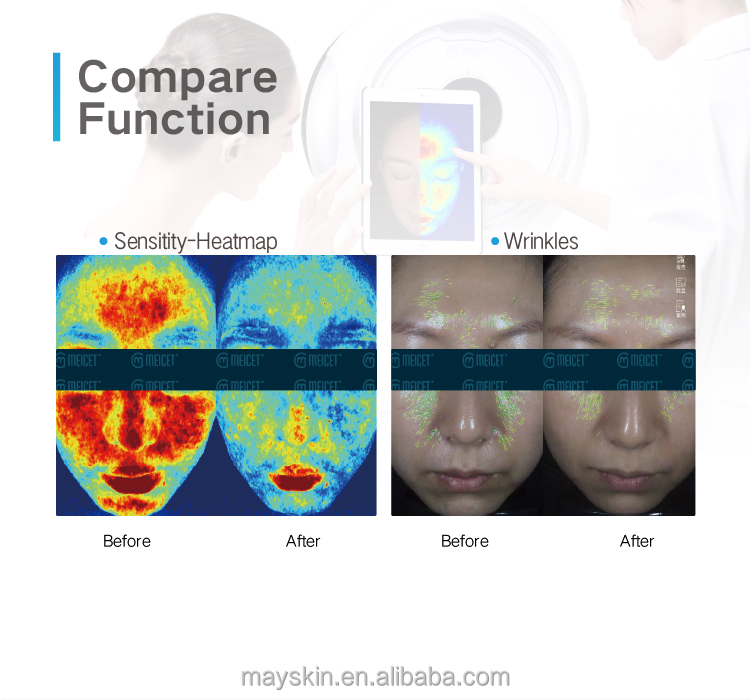 Smart AI Magic Mirror Facial Skin Analyzer Machine LED 5-Spectrum Skin Analysis Aging Treatment JP/US/ZA iPad Control Commercial