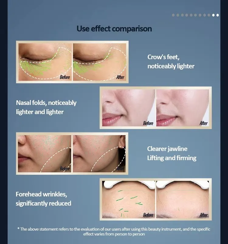 Hot Sale Multi-Function RF EMS LED Light Dark Circles Anti-Aging Facial Instrument Face Firming Eye Massager