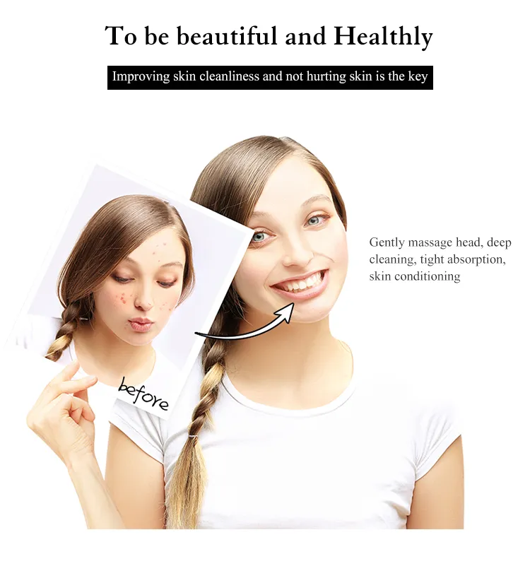 Heated Vibration Facial Massager