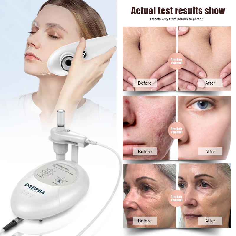 DEP Skin Hydration Machine Non-Invasive Personal Care Health Medical Handheld Face Massager Dep Facial Tighten Home Use Device