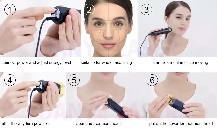 Tripollar RF Skin Tightening Detail 3