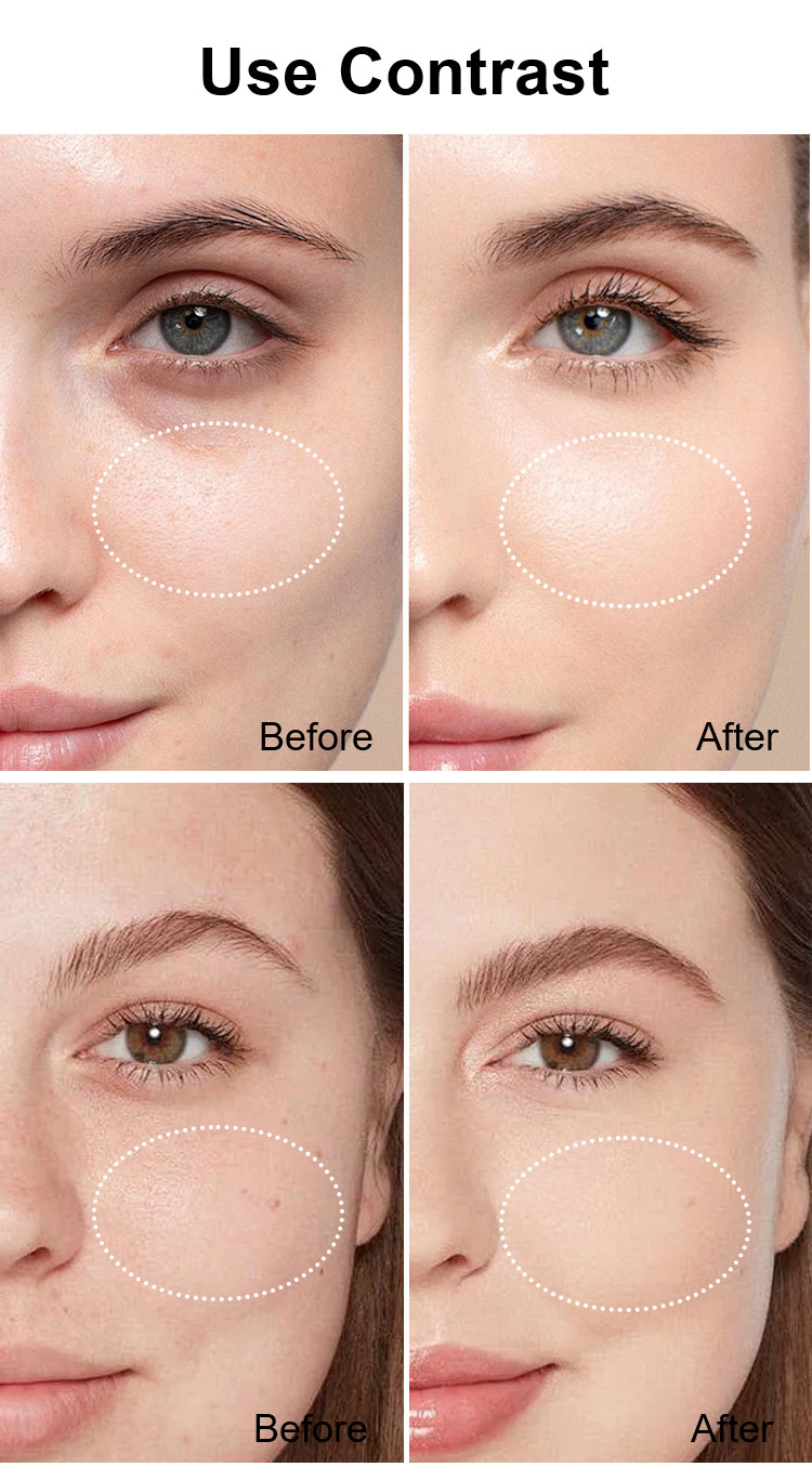 Skin Problems 2