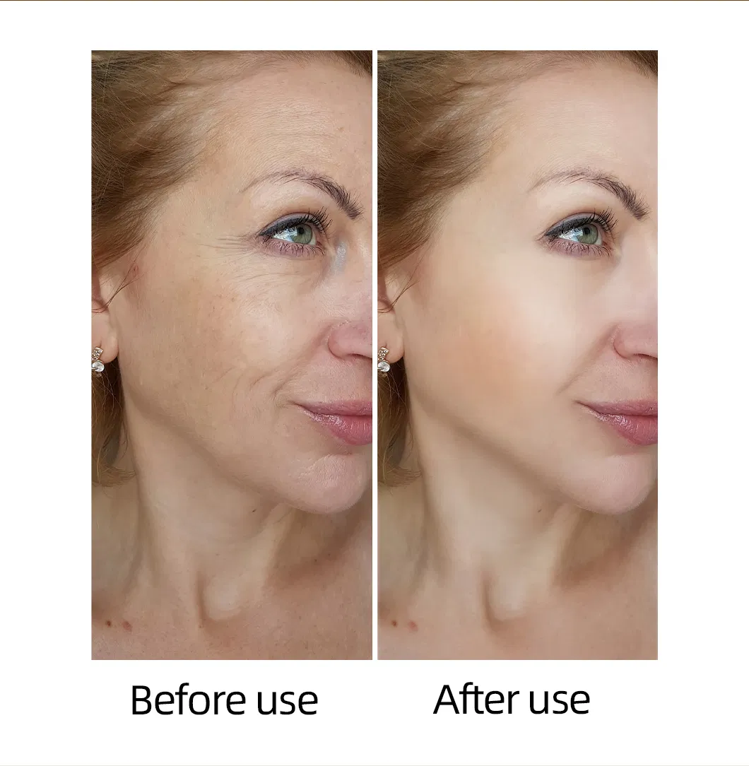 Óleo de Suspensão Rejuvenescedor para a Pele Cosméticos de Beleza Sérum Facial Antienvelhecimento