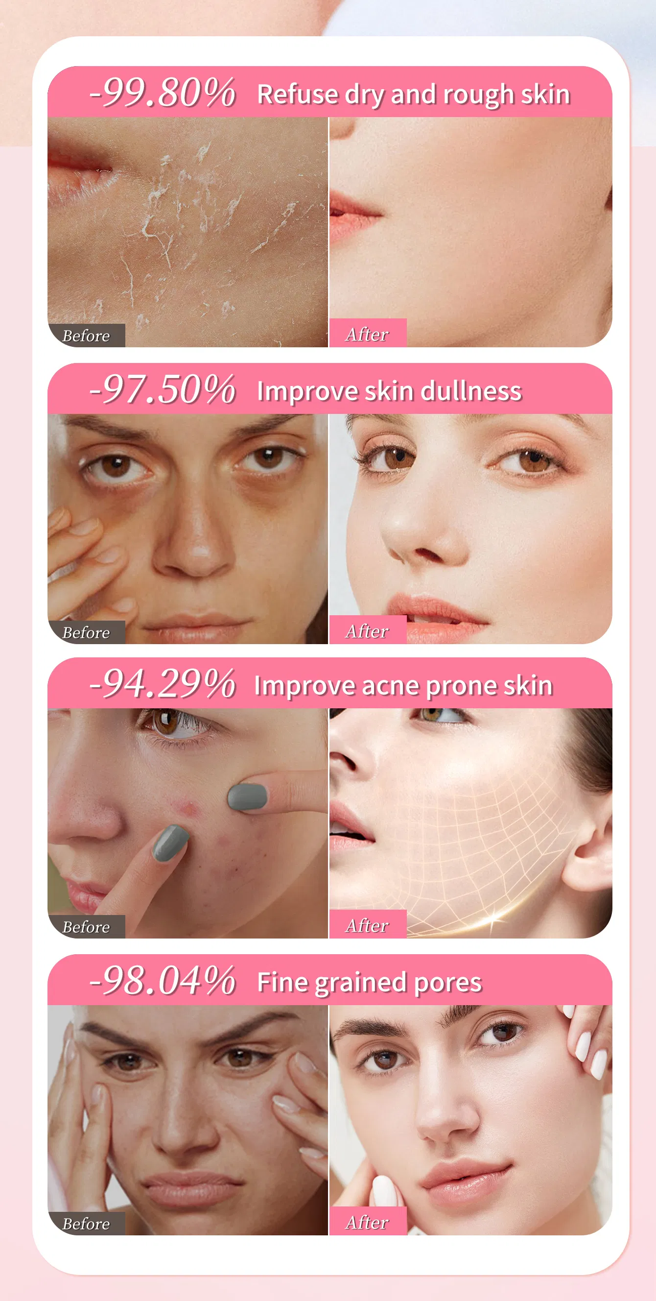 Uniformiza o tom de pele irregular, firma a pele, acalma a sensibilidade, repara a barreira cutânea danificada, sérum facial de sakura
