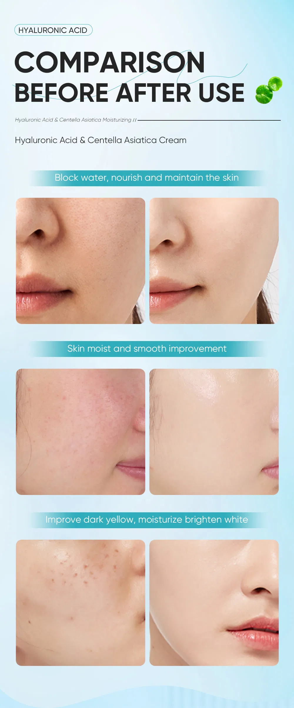Acalma a pele irritada, repara a barreira, proporciona hidratação duradoura, ácido hialurônico, centella asiática, creme facial hidratante