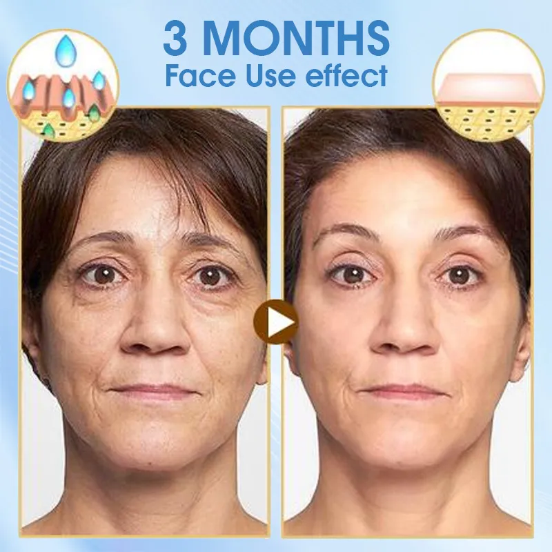 Creme Diurno Hidratante Profundo Anti-Idade Reparar Manter a Barreira Natural da Pele SPF15