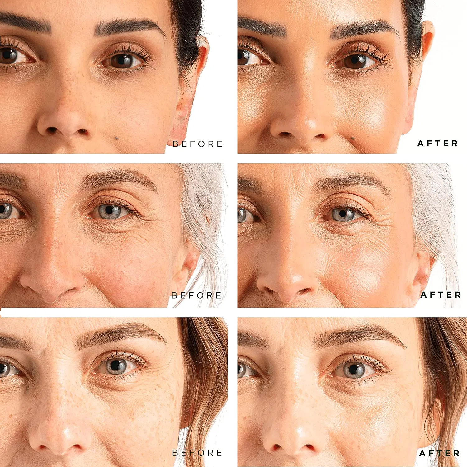 Sérum Facial Complexo Firmador Iluminador Antienvelhecimento de Ácido Hialurônico OEM Pacote Combinado