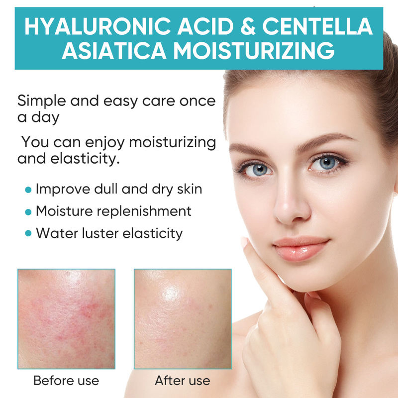 Acalma a pele irritada, repara a barreira, proporciona hidratação duradoura, ácido hialurônico, centella asiática, creme facial hidratante