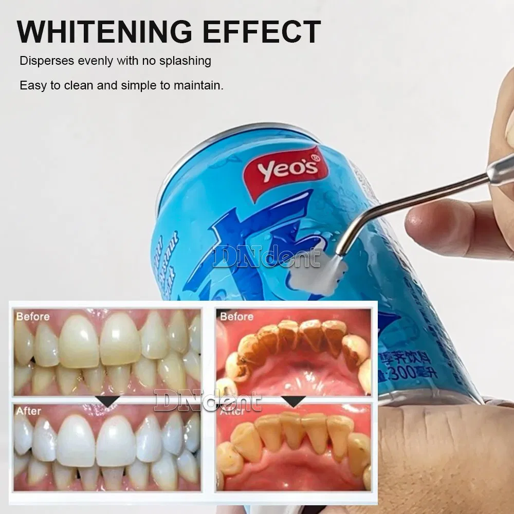 Air Prophy Unit Design