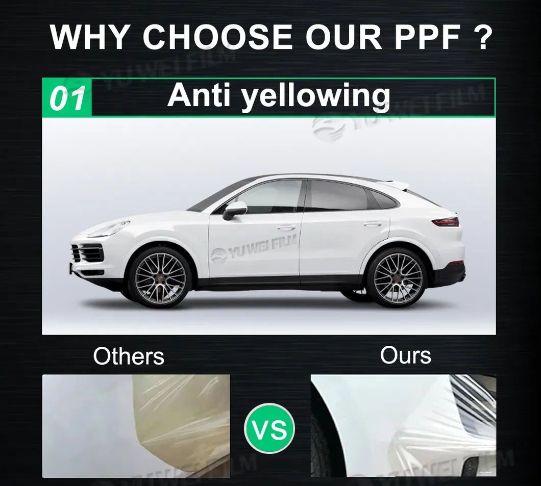 PPF Advantage 1