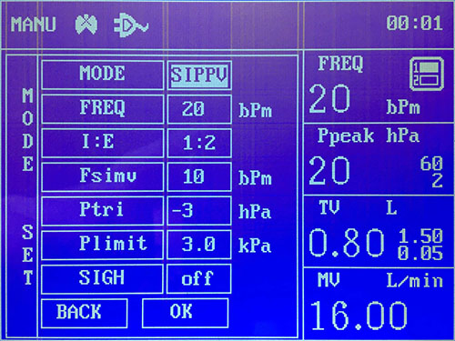 Multi-Function ICU Medical Equipment Anesthesia Machine in China Jinling 01b Anesthesia Workstation with Ventilator
