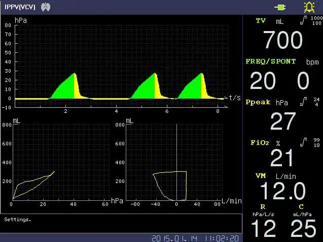 Anesthesia Machine Interface