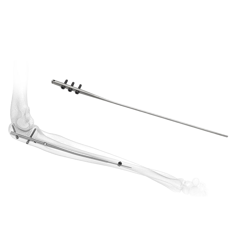 Product View 1