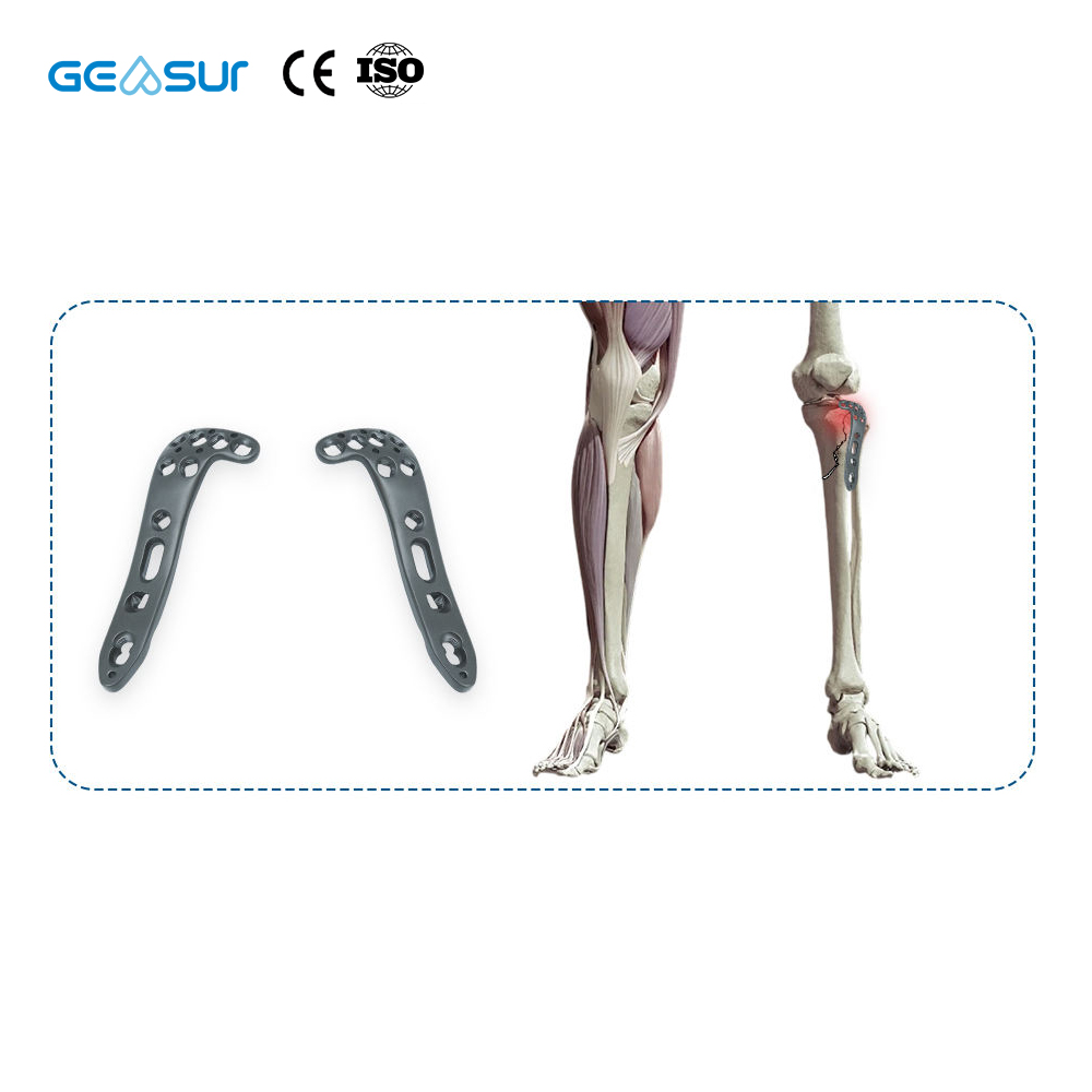 Geasure Titanium Alloy Anatomical Proximal Tibia Lateral Locking Plate for Hospital Orthopedic Fracture Fixation