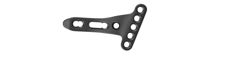 Locking Plate Overview
