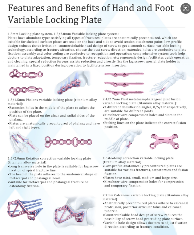 Volar Distal Radius Support Locking Plate Detail 2