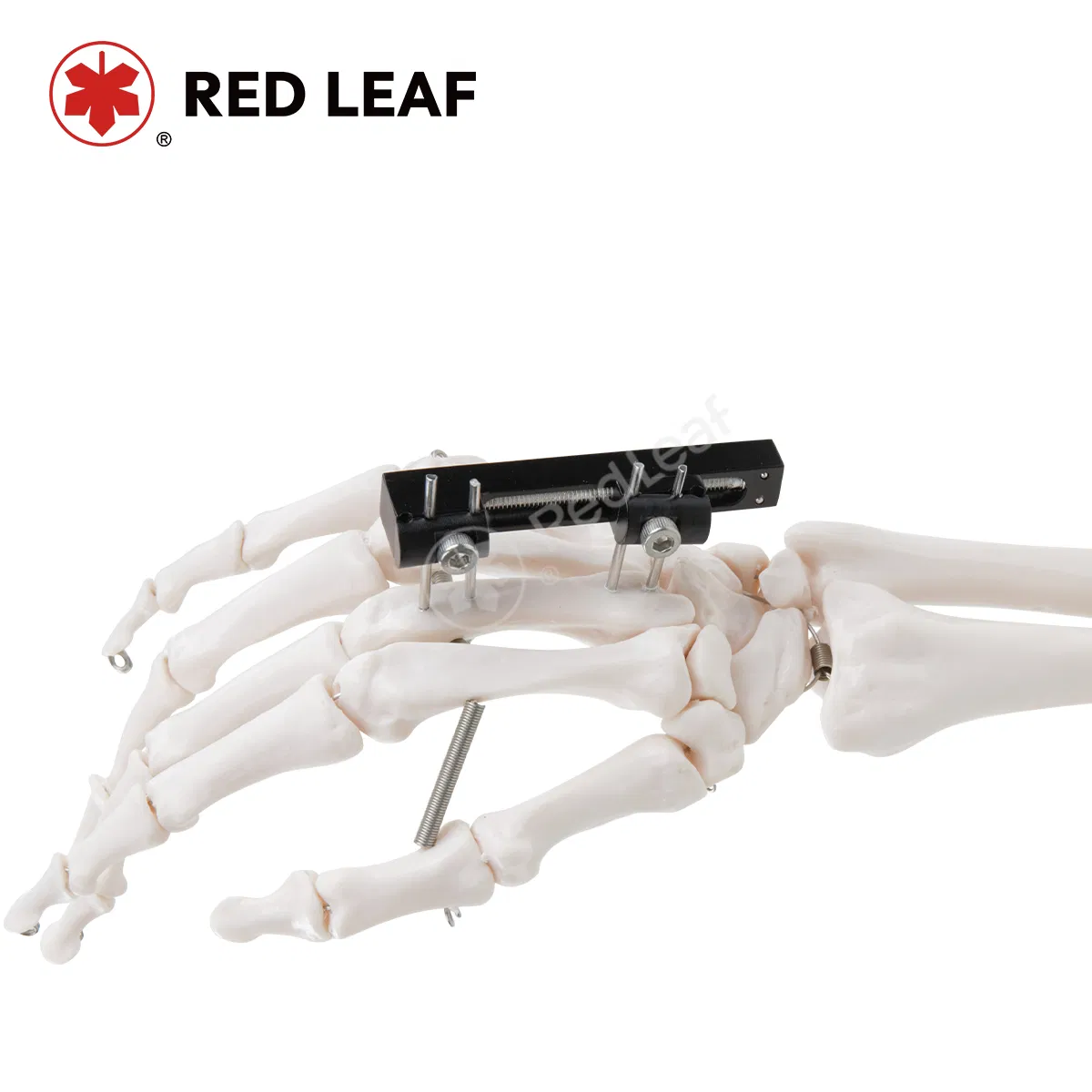 Mini Finger Palm Straight Track External Fixator for Orthopedic Surgical Fracture Fixation