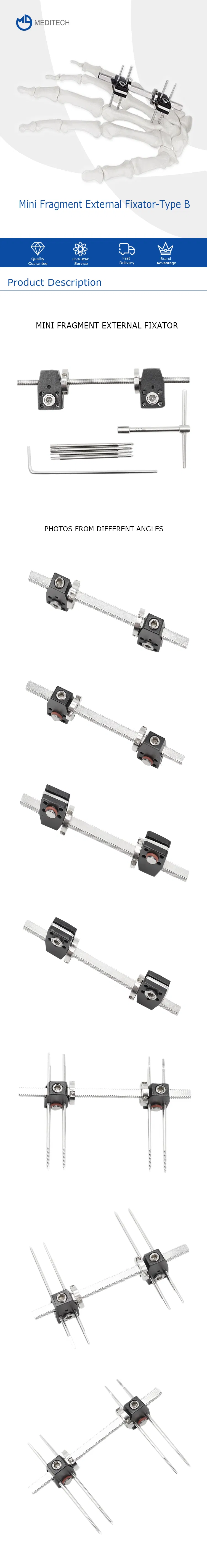 Mini Fragment External Fixator Infographic