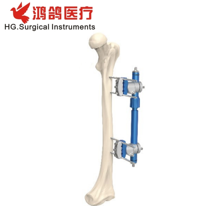 Orthopedic Instrument Combination External Fixator Ankle Fusion Joint Fixator