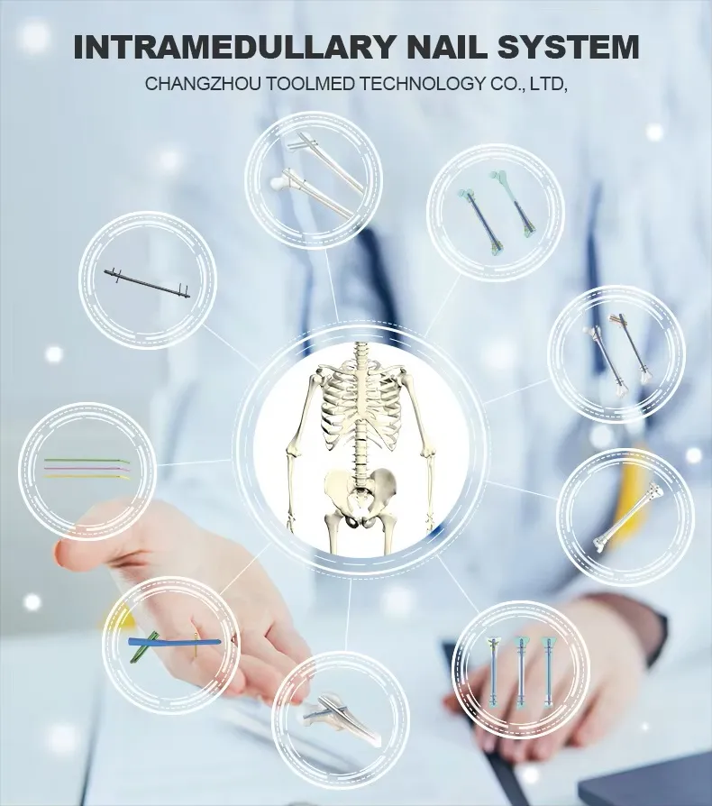 Pfna Nail Instrument Set 1
