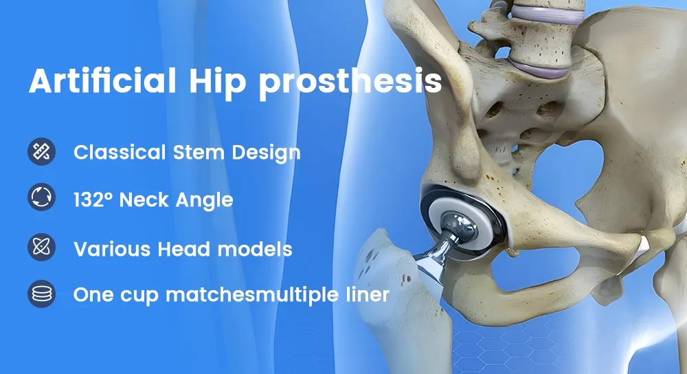 Hip Joint Replacement Details