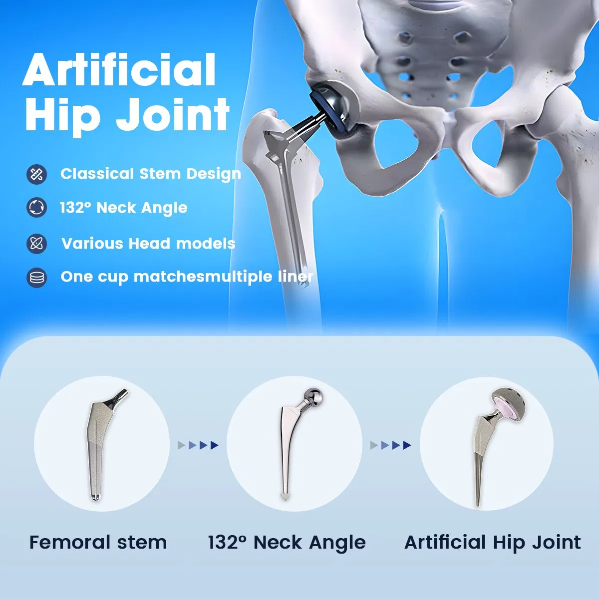 Orthopedic Surgical Total Hip Joint Replacement Hip Prothesis Replacement Implant
