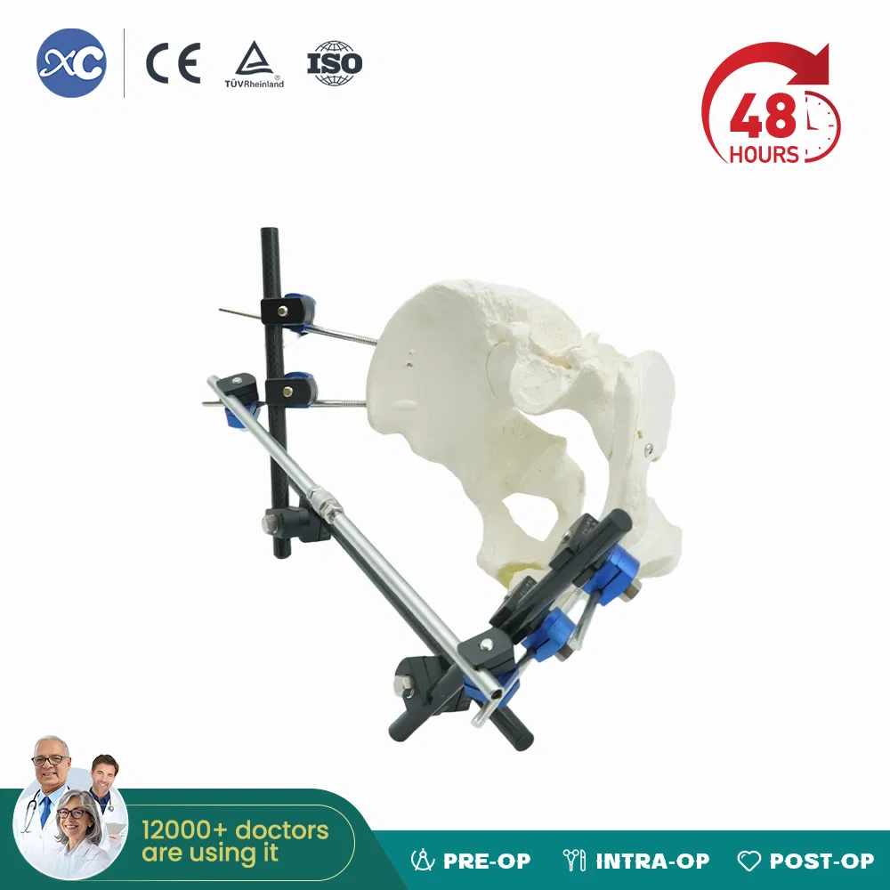 Orthopedic Equipment External Fixator External Fixation of Pelvis and Ankles
