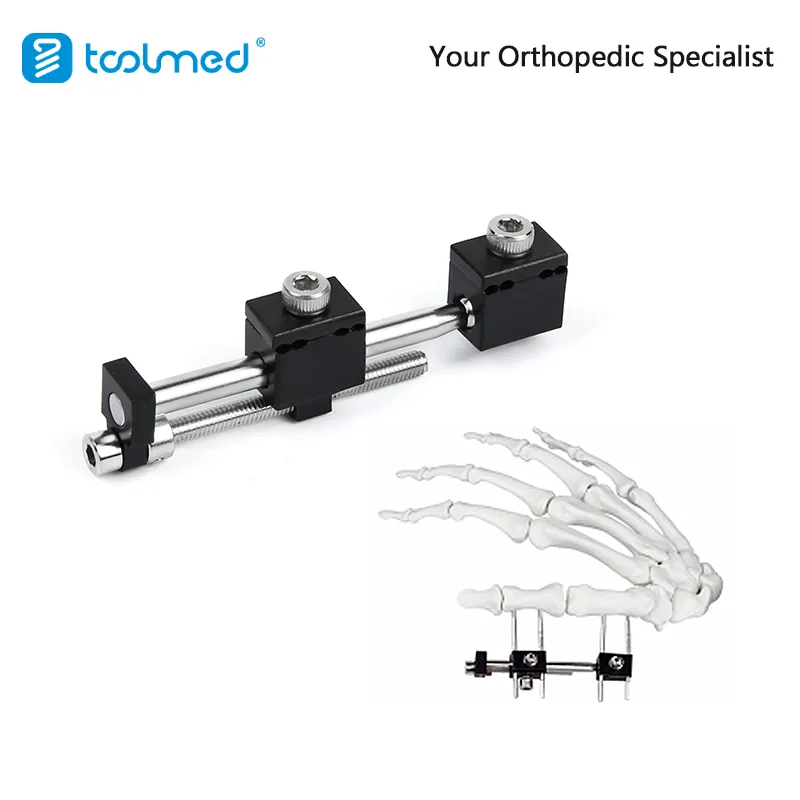 Orthopedic External Fixator