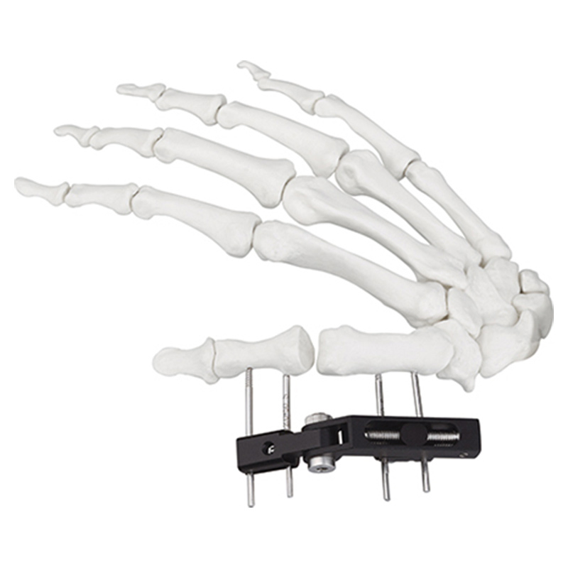 Orthopedic Surgical Fixation Mini External Fixator Universal Compression Extension Type