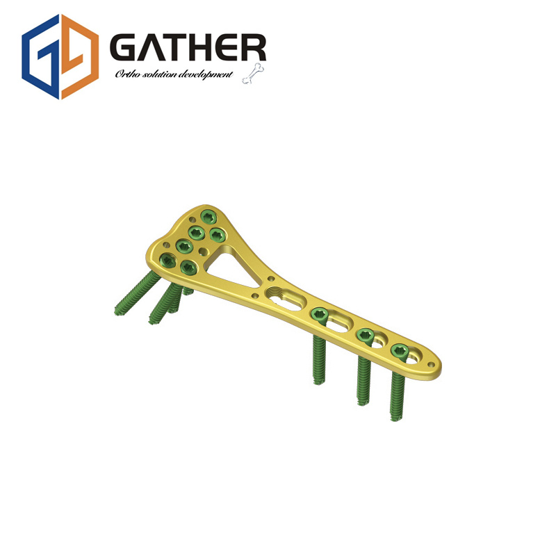 Locking Plate Multi Axial for Distal Radius Fracture Orthopedic Surgery Implants