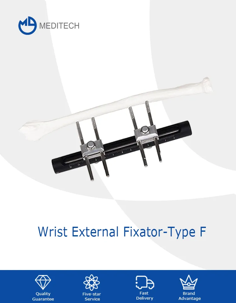 Wrist Joints External Fixator 1
