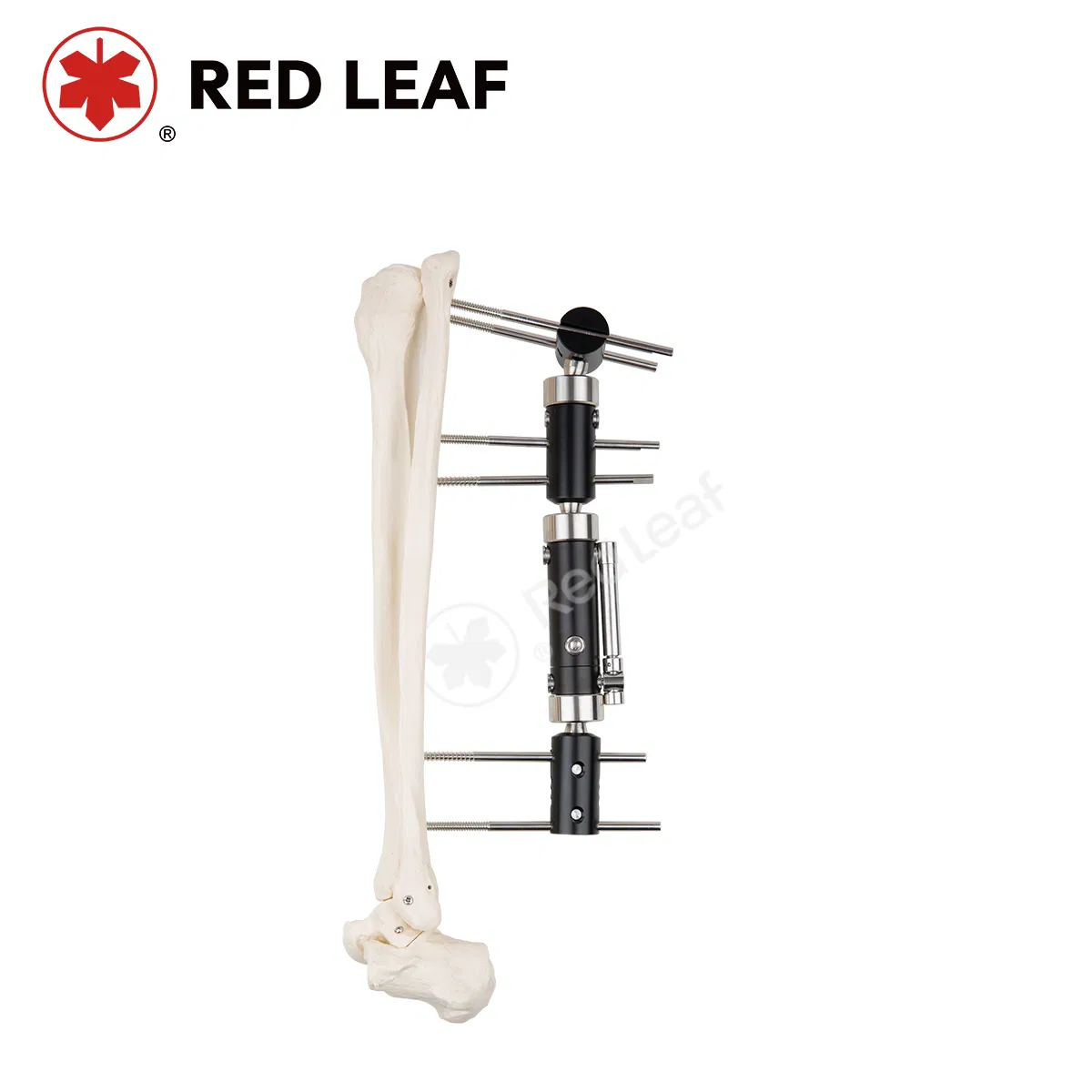 Innovative Three Section T Type External Fixator for Orthopedic Fracture Treatment