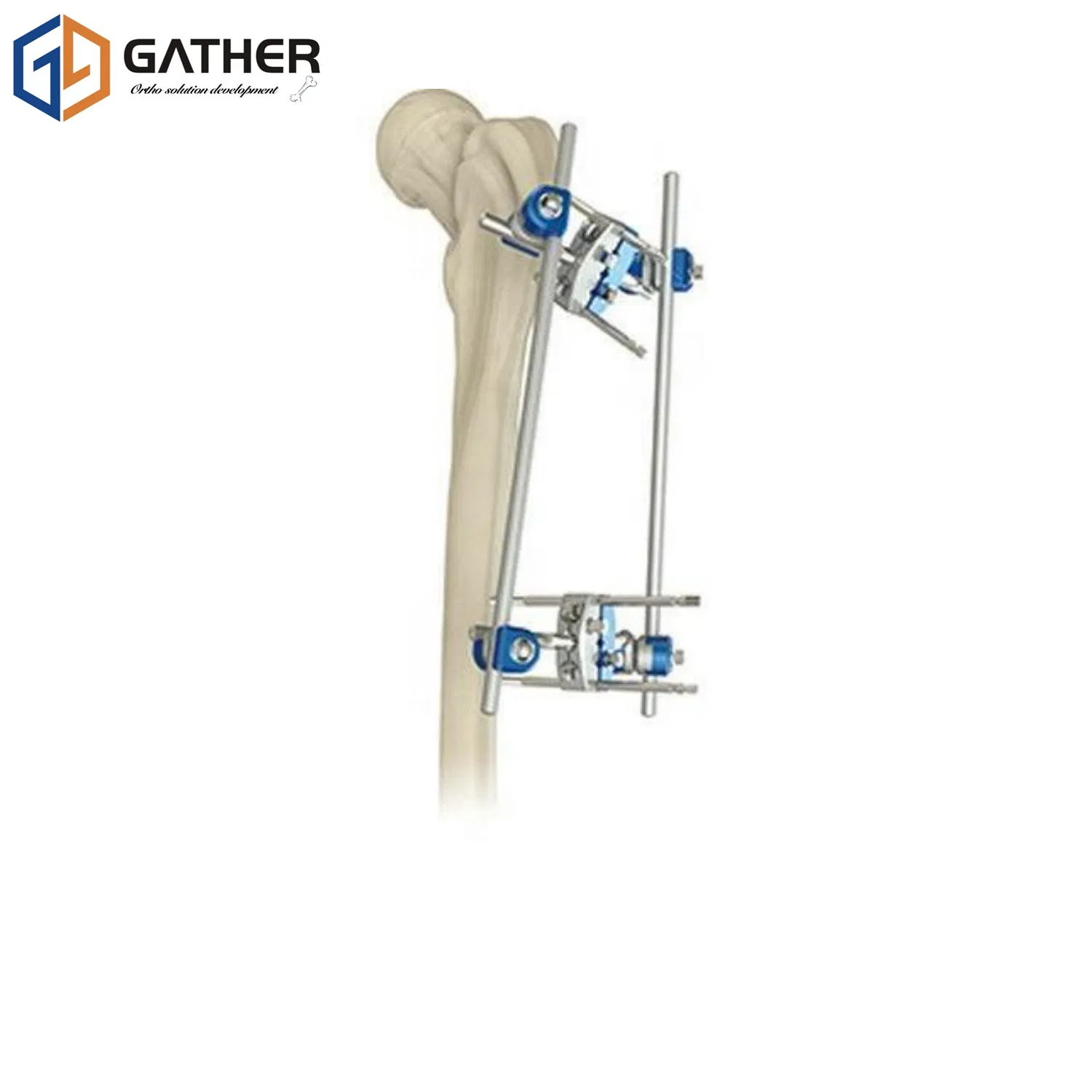 Customized ISO Approved Fracture Fixation Posture Corrector Lumbar Support Wholesale Piece Splint External Fixator