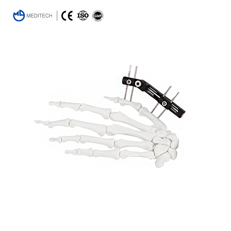Meditech Mini Fixator Combined Type Orthopedic External Fixator Orthopedic Device Mini Finger and Palm Fixator