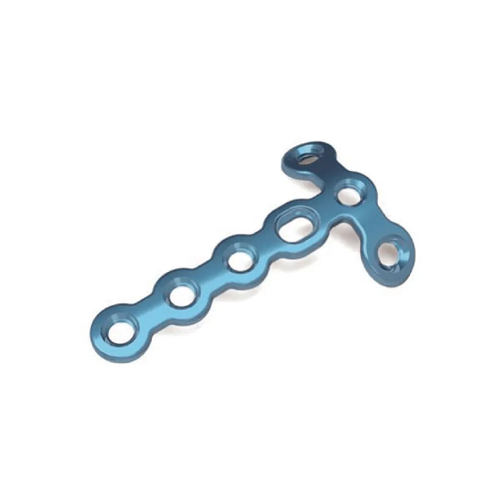 Nx Medical Va Locking Plate Implants LCP Hand &amp; Foot Fracture Fixation System