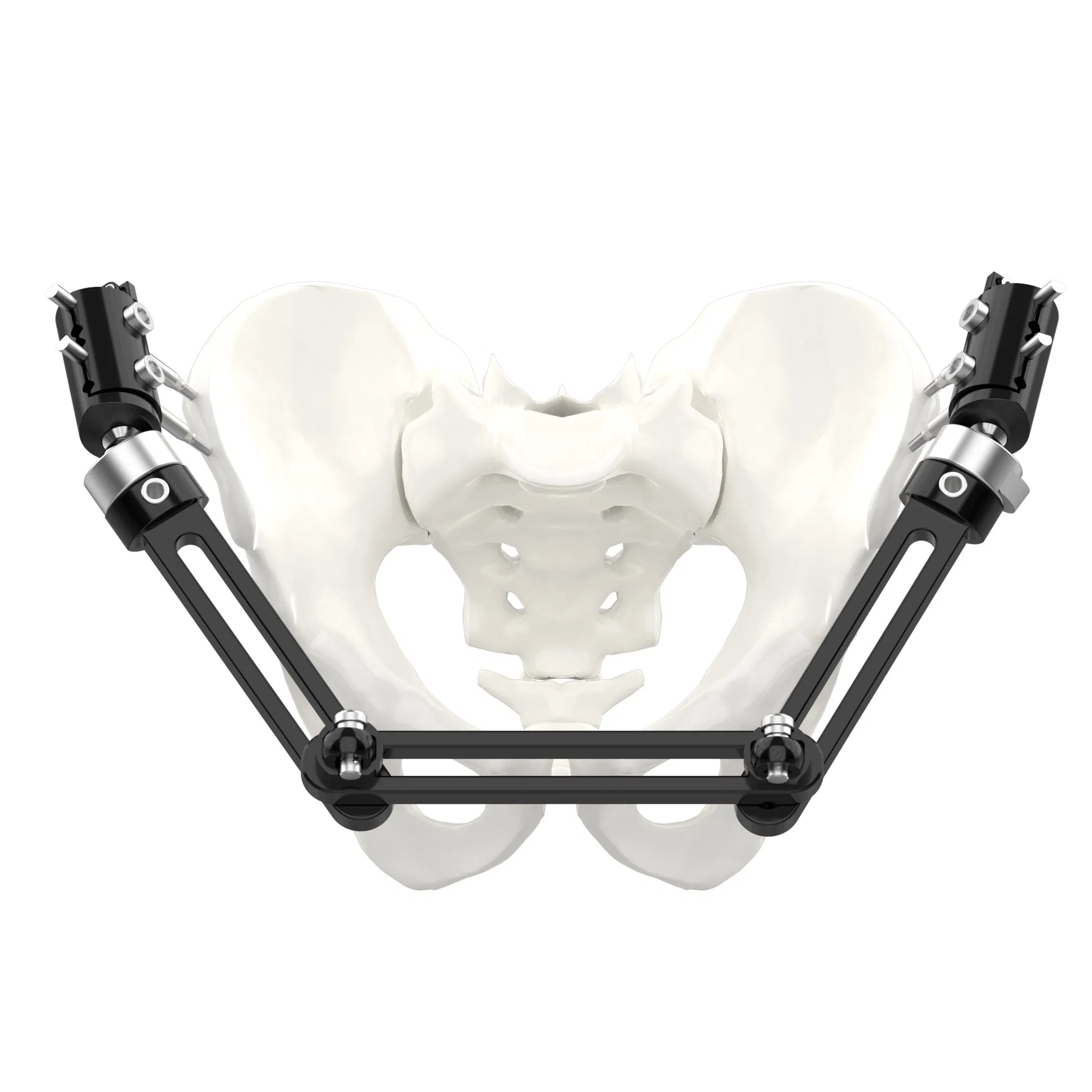 Canwell Elbow External Fixator Medium Tubular Bones Fracture Fixation Elbow Hinge Fixator Orthopedic Trauma Implant System