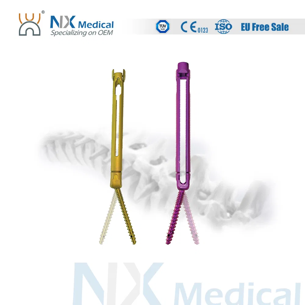 Nx Medical Titanium Cannulated Bone Cement Spinal Pedicle Screw Minimium Invasive