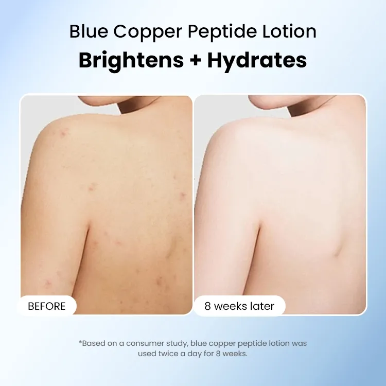 Delivers Deep Hydration and Improves Skin Elasticity Hyaluronic Acid Blue Copper Peptide Anti-Aging Body Lotion