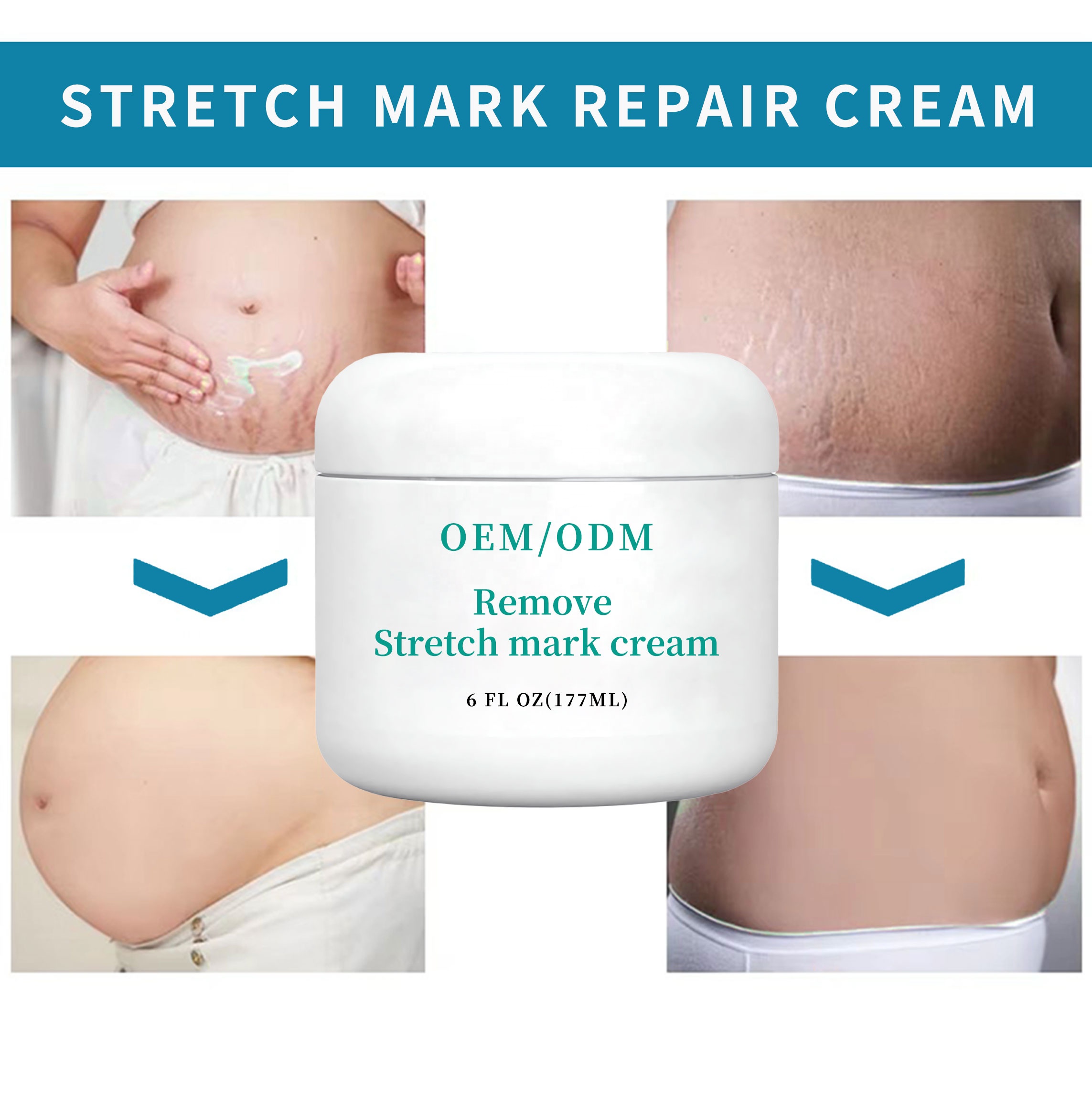 Sensitive Skin Postpartum Stretch Mark Cream Body Pregnancy Scar Stretch Marks Cream for Women Removal Skin Repair Cream