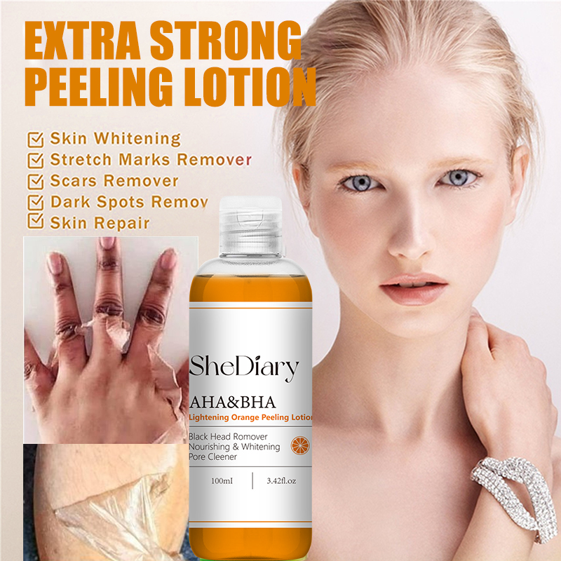 Zhenyan 100ml Orange Peeling Lotion OEM ODM Body Lotion for Exfoliating Blackheads Nourishing and Brightening Skin