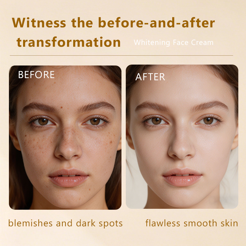 Whitening Face Cream With Niacinamide Vitamin C For Dark Spots Uneven Skin Tone Daily Moisturizer For Women