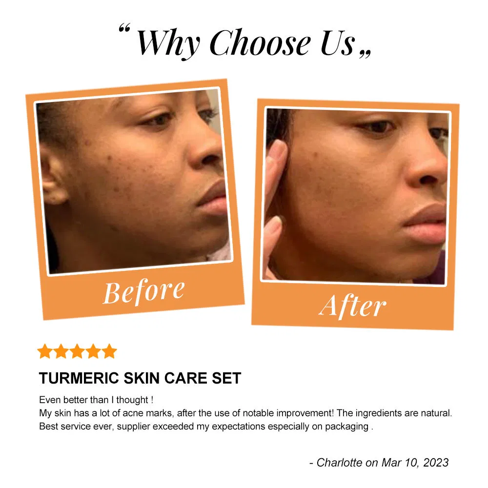Turmeric Brightening and Spot-Reducing Body Lotion Customized for Women Dark Skin