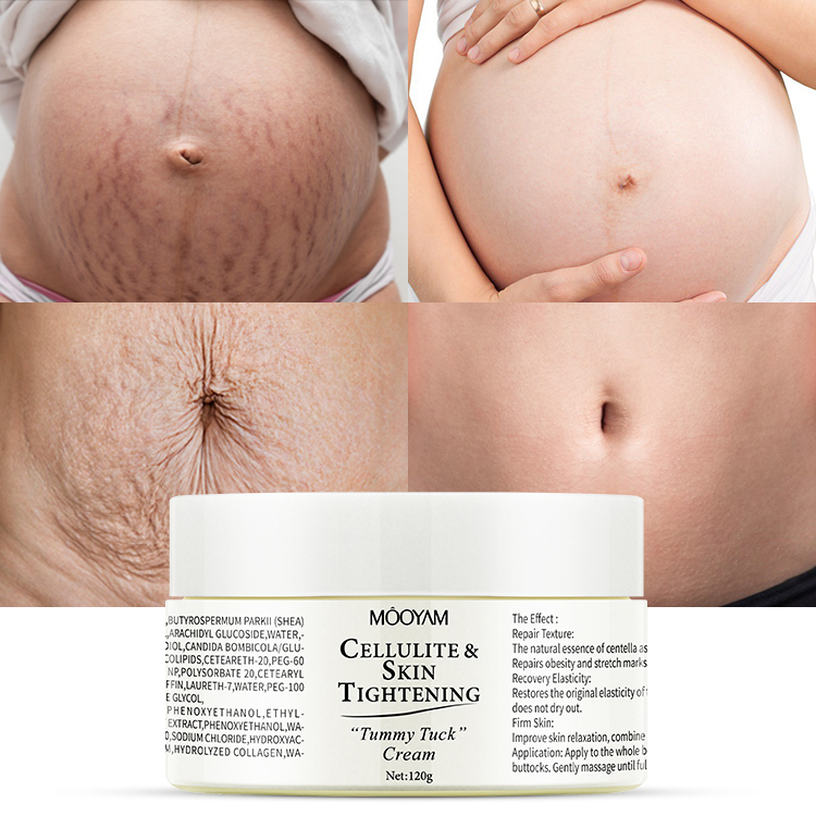 Organic Stretch Mark Removal Cream Body Tummy Tuck Repair Treatment Lotion Moisturizing Scar Removal Cream Shea Butter Herbal