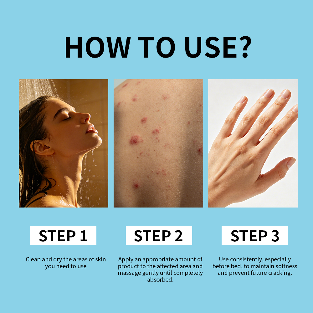 Private Label Premium Natural Herbal Skin Care Product 24H Hydrating Soothing Psoriasis Moisturizing Cream