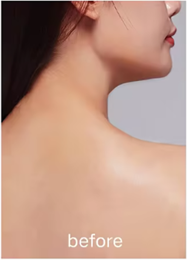 Before Use
